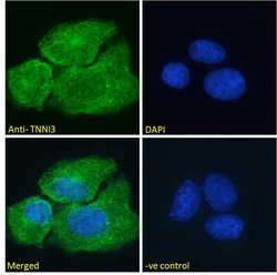 Invitrogen Cardiac Troponin I Polyclonal Antibody 100 μg; Unconjugated:Antibodies,