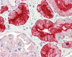 Invitrogen GGT1 Polyclonal Antibody 100 &mu;g | Buy Online | Invitrogen&trade; | Fisher Scientific