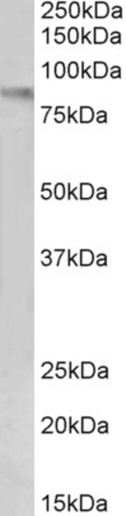 Invitrogen VCAM-1 (CD106) Polyclonal Antibody 100 &mu;g; Unconjugated:Antibodies,