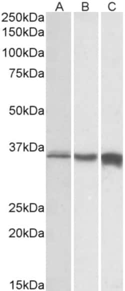 Invitrogen TNNT3 Polyclonal Antibody, Biotin 100 &mu;g; Biotin:Antibodies,