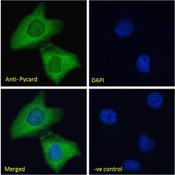 Invitrogen PYCARD Polyclonal Antibody 100 &mu;g; Unconjugated:Antibodies,