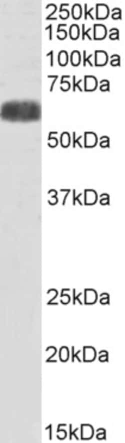 Invitrogen YLAT2 Polyclonal Antibody 100 &mu;g; Unconjugated:Antibodies,