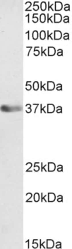 Invitrogen ATF1 Polyclonal Antibody 100 &mu;g; Unconjugated:Antibodies,