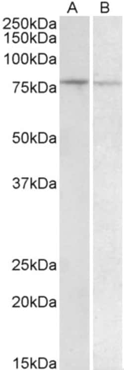 Invitrogen BACH1 Polyclonal Antibody 100 &mu;g | Buy Online | Invitrogen&trade; | Fisher Scientific