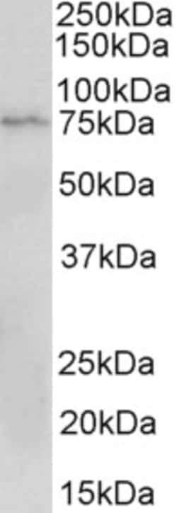 Invitrogen CD19 Polyclonal Antibody 100 μg; Unconjugated:Antibodies,