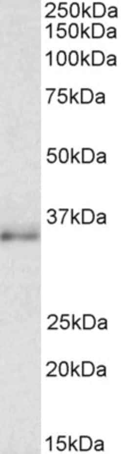Invitrogen C/EBP beta Polyclonal Antibody 100 &mu;g; Unconjugated:Antibodies,