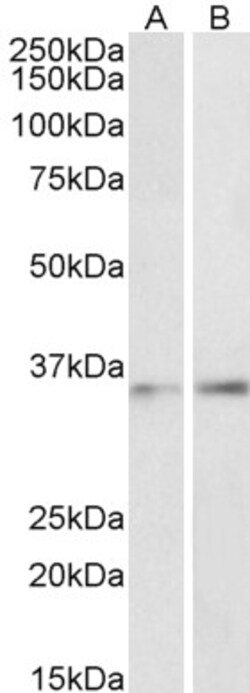 Invitrogen C/EBP beta Polyclonal Antibody 100 &mu;g; Unconjugated:Antibodies,