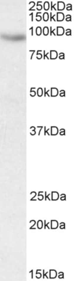 Invitrogen CIZ1 Polyclonal Antibody 100 &mu;g; Unconjugated:Antibodies,