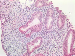 Invitrogen DPF2 Polyclonal Antibody 100 &mu;g; Unconjugated:Antibodies,