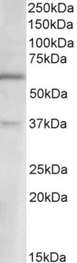 Invitrogen VGLUT2 Polyclonal Antibody 100 &mu;g; Unconjugated:Antibodies,