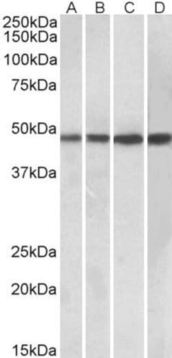 Invitrogen C1orf165 Polyclonal Antibody 100 &mu;g; Unconjugated:Antibodies,