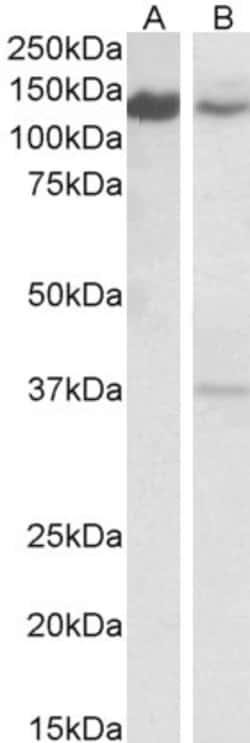 Invitrogen ARS2 Polyclonal Antibody 100 &mu;g; Unconjugated:Antibodies,
