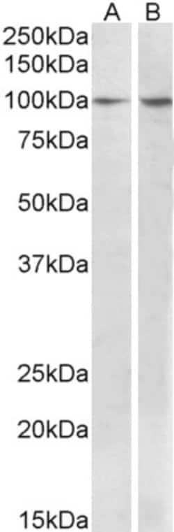 Invitrogen p130Cas Polyclonal Antibody 100 &mu;g; Unconjugated:Antibodies,
