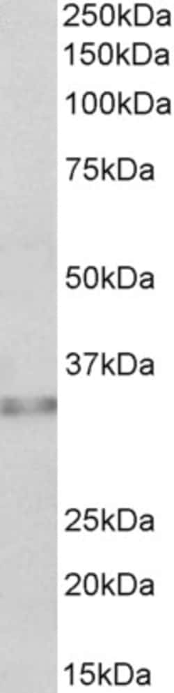 Invitrogen Caspase 6 Polyclonal Antibody 100 μg; Unconjugated:Antibodies,