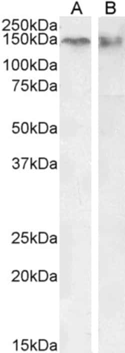 Invitrogen CTCF Polyclonal Antibody 100 &mu;g; Unconjugated:Antibodies,