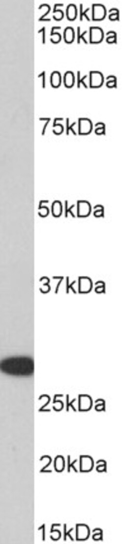 Invitrogen HOXA5 Polyclonal Antibody 100 μg; Unconjugated:Antibodies,