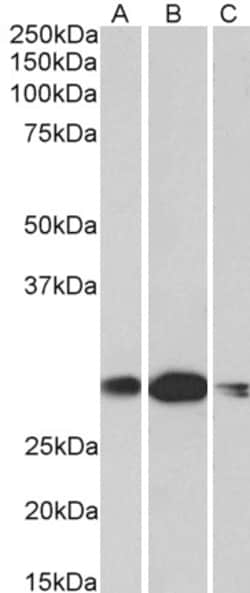 Invitrogen HOXA5 Polyclonal Antibody 100 μg; Unconjugated:Antibodies,
