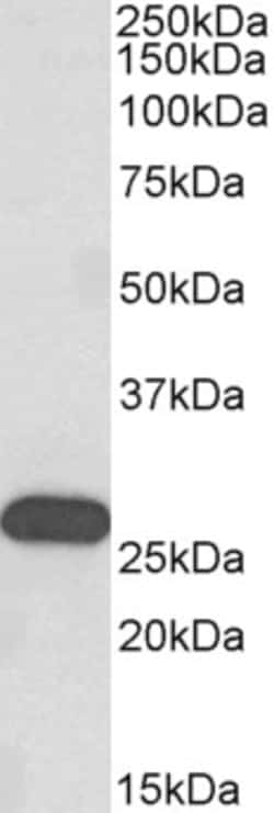 Invitrogen HOXC6 Polyclonal Antibody 100 &mu;g; Unconjugated:Antibodies,
