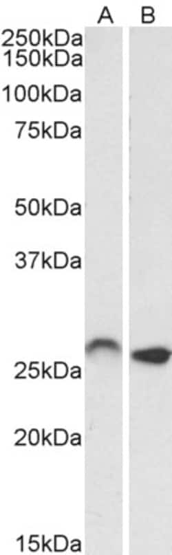 Invitrogen HOXC6 Polyclonal Antibody 100 &mu;g; Unconjugated:Antibodies,