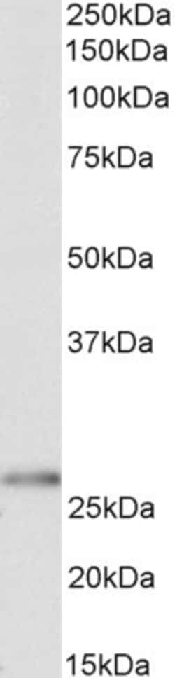 Invitrogen HOXC6 Polyclonal Antibody 100 &mu;g; Unconjugated:Antibodies,
