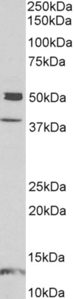 Invitrogen NPTX1 Polyclonal Antibody 100 &mu;g; Unconjugated:Antibodies,