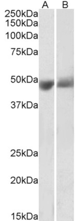 Invitrogen PEDF Polyclonal Antibody 100 μg; Unconjugated:Antibodies,