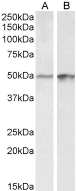 Invitrogen E2F4 Polyclonal Antibody 100 &mu;g; Unconjugated:Antibodies,