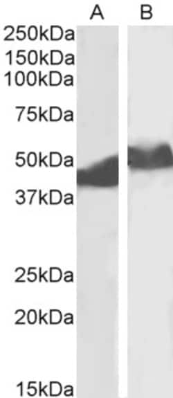 Invitrogen alpha-1 Antitrypsin Polyclonal Antibody 100 &mu;g; Unconjugated:Antibodies,