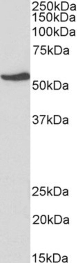 Invitrogen NR5A2 Polyclonal Antibody 100 &mu;g; Unconjugated:Antibodies,