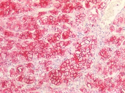 Invitrogen&trade;&nbsp;SR-BI Polyclonal Antibody