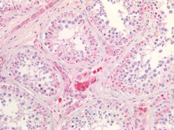 Invitrogen SR-BI Polyclonal Antibody 100 &mu;g | Buy Online | Invitrogen&trade; | Fisher Scientific