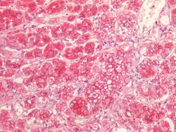 Invitrogen SR-BI Polyclonal Antibody 100 &mu;g; Unconjugated:Antibodies,