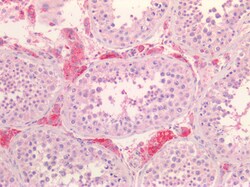 Invitrogen SR-BI Polyclonal Antibody 100 &mu;g; Unconjugated:Antibodies,