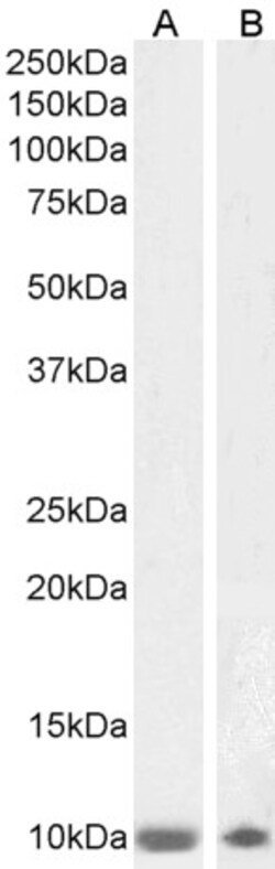 Invitrogen S100B Polyclonal Antibody 100 &mu;g; Unconjugated:Antibodies,