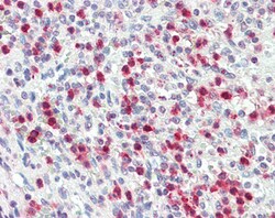 Invitrogen PR3 Polyclonal Antibody 100 &mu;g | Buy Online | Invitrogen&trade; | Fisher Scientific