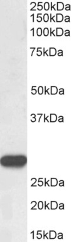 Invitrogen PR3 Polyclonal Antibody 100 &mu;g | Buy Online | Invitrogen&trade; | Fisher Scientific