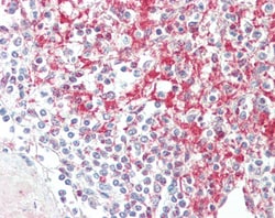 Invitrogen ADAM19 Polyclonal Antibody 100 &mu;g; Unconjugated:Antibodies,