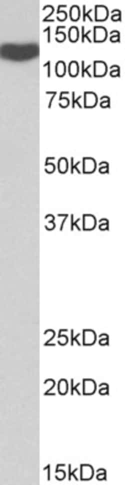Invitrogen ADAM19 Polyclonal Antibody 100 &mu;g; Unconjugated:Antibodies,