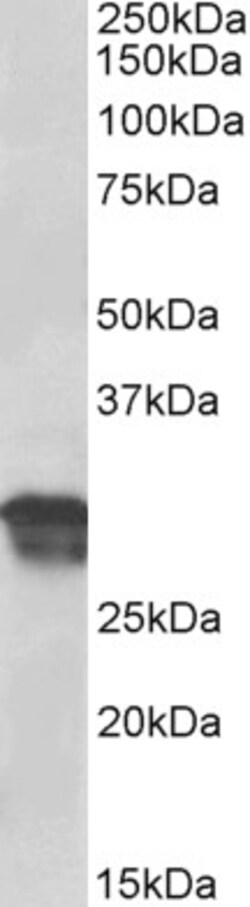 Invitrogen Cyclin D1 Polyclonal Antibody 100 &mu;g; Unconjugated:Antibodies,