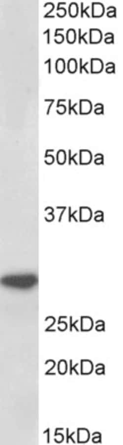 Invitrogen IL-1 beta Polyclonal Antibody 100 &mu;g; Unconjugated:Antibodies,