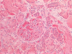 Invitrogen AFP Polyclonal Antibody 100 &mu;g; Unconjugated:Antibodies,