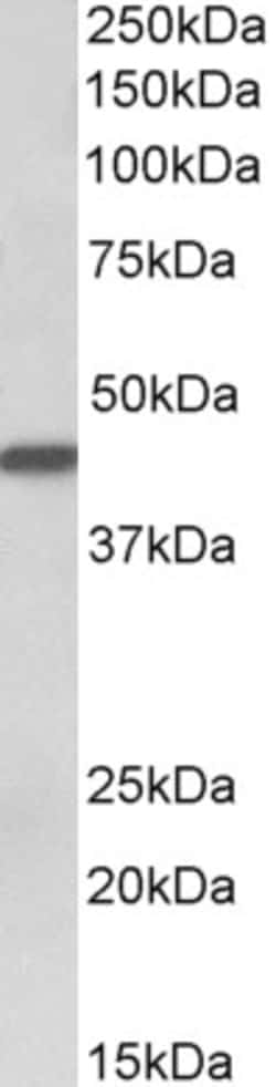 Cytokeratin 19 Polyclonal Antibody, Invitrogen 100 &mu;g; Unconjugated:Antibodies,