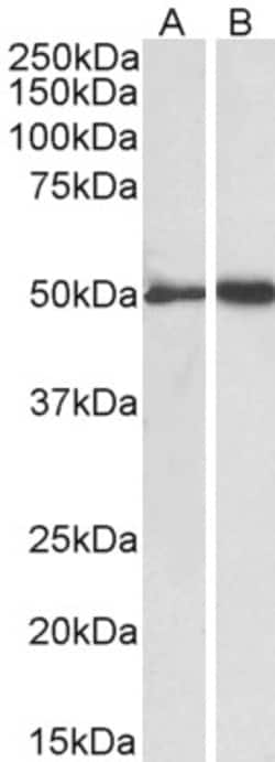 Invitrogen Fibrinogen gamma Polyclonal Antibody 100 μg; Unconjugated:Antibodies,