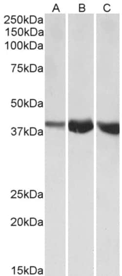 Invitrogen Aldolase A Polyclonal Antibody 100 &mu;g; Unconjugated:Antibodies,