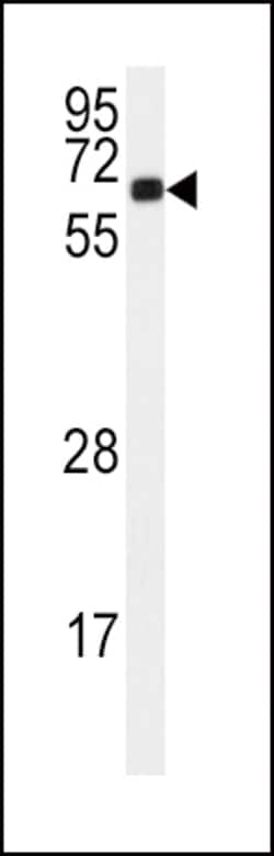 Invitrogen CaMKII alpha Polyclonal Antibody 400 μL; Unconjugated:Antibodies,