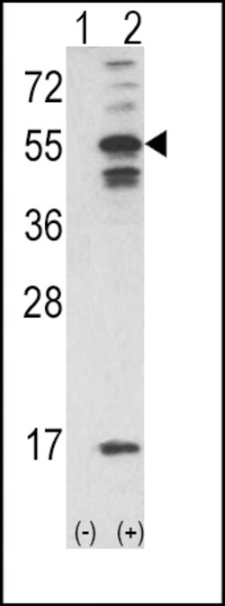 Invitrogen CaMKII alpha Polyclonal Antibody 400 μL; Unconjugated:Antibodies,