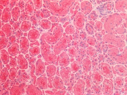 Invitrogen LDHB Polyclonal Antibody 100 &mu;g | Buy Online | Invitrogen&trade; | Fisher Scientific