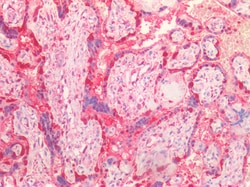 Invitrogen LDHB Polyclonal Antibody 100 &mu;g | Buy Online | Invitrogen&trade; | Fisher Scientific