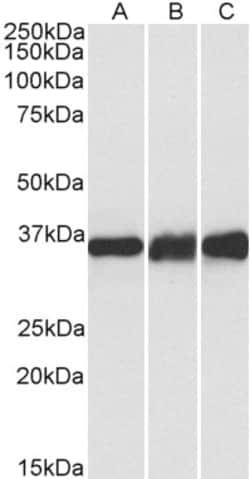 Invitrogen LDHB Polyclonal Antibody 100 &mu;g | Buy Online | Invitrogen&trade; | Fisher Scientific