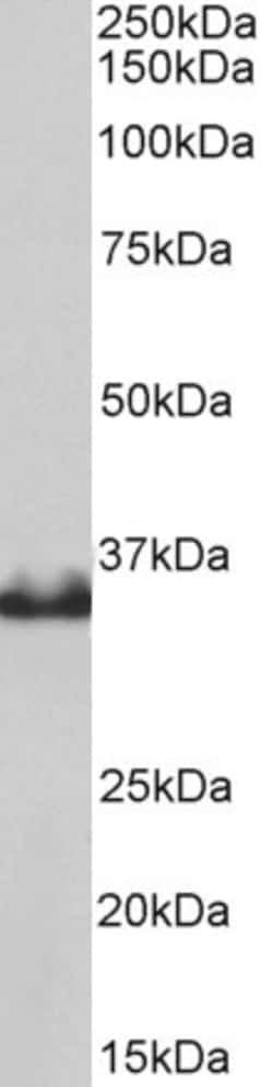 Invitrogen LDHB Polyclonal Antibody 100 &mu;g | Buy Online | Invitrogen&trade; | Fisher Scientific